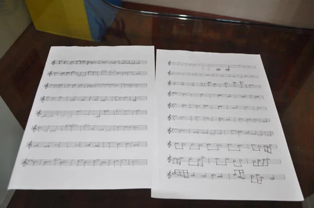 Beykoz'da otistiklere el uzanacak mı? 3 otistik samed rop 10 eAXLAUzBXe