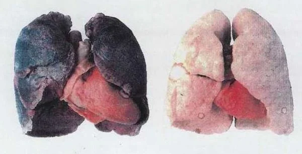 İçmeseydiniz neler yapabilirdiniz? 4