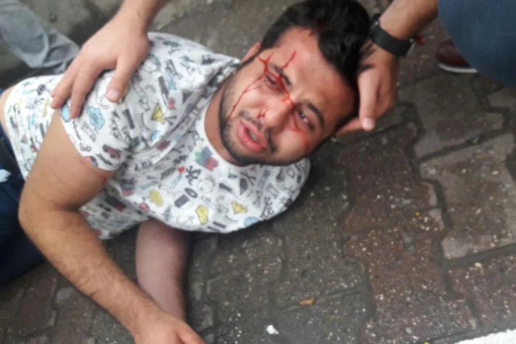 Beykoz Sultaniye yolunda trafik kazası… 1 yaralı 2 sultaniye ka Gypib3c8s